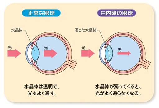 Fig2.眼の構造