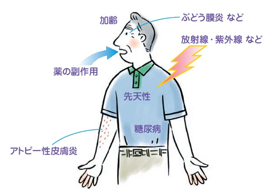 Fig3.白内障の種類と原因