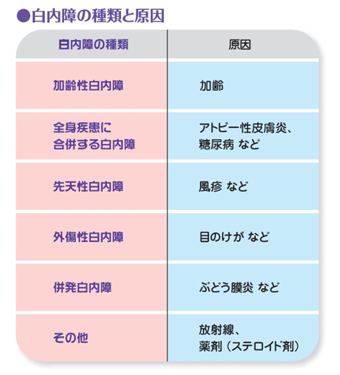 Fig4.白内障の種類と原因